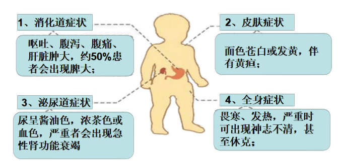蚕豆病具有遗传倾向,现已成为新生儿筛查的项目之一,尤其是家族中已