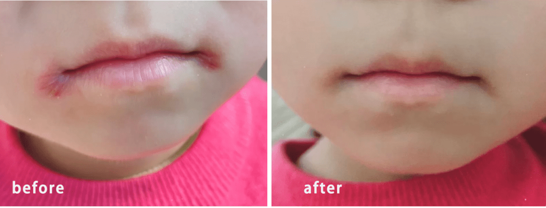 急救|唇纹又深又显老!急救起皮干裂,嘴巴像融化了一样,又软又糯贼滑溜!