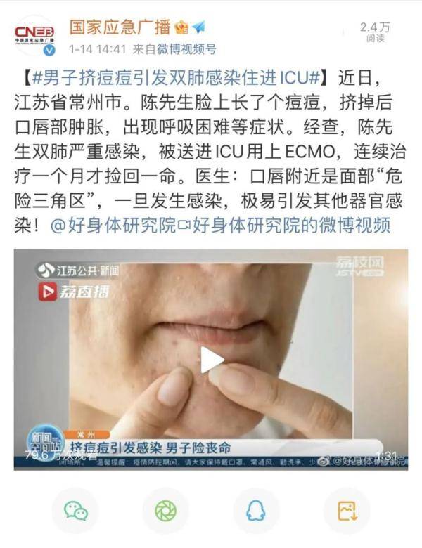 面部|他挤了一下脸上的痘痘，差点没了命