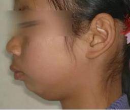 大部分|打呼噜严重时也是病，相当于夜夜溺水，警惕心血管风险