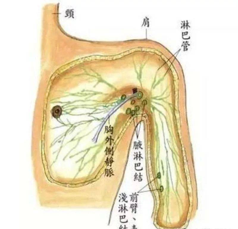 腋窝淋巴结分区 区域图片