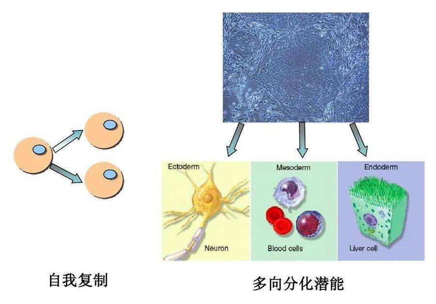 每20人就有一個痛風患者,幹細胞帶來新希望