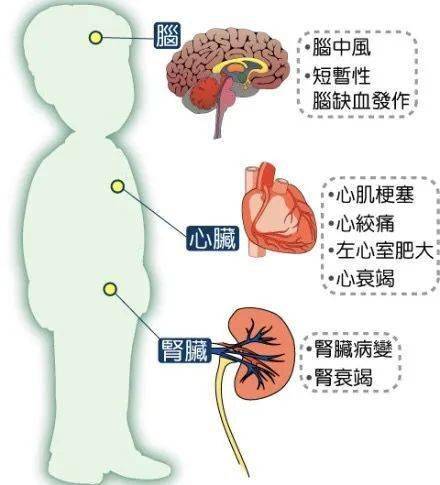 ②感冒藥 降壓藥=影響血壓;③布洛芬 萘普生 阿司匹林=胃