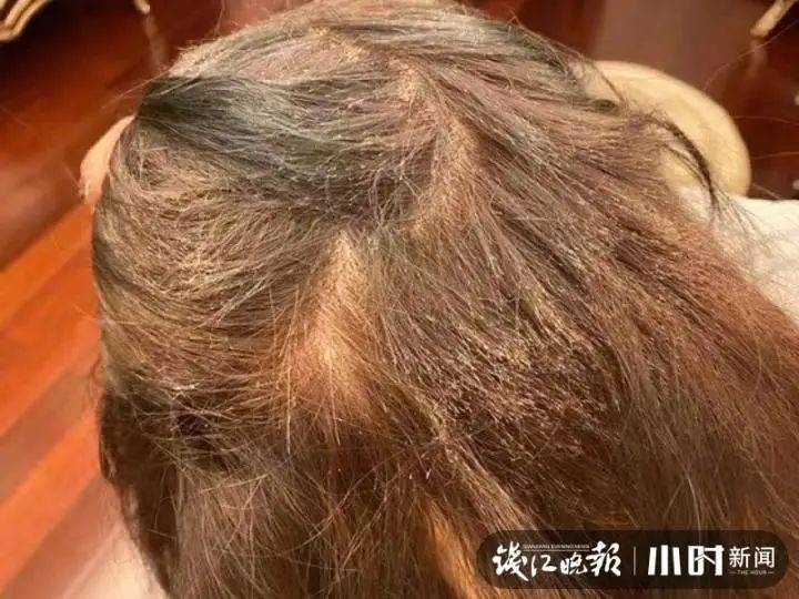 头发女生花1000元染发成了这副模样：赔我20万！店长懵了