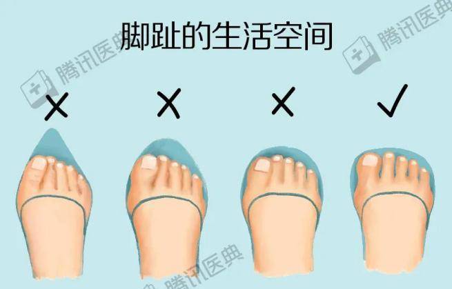 高跟鞋|“鸡眼”偏爱这4种人，你中招了吗？