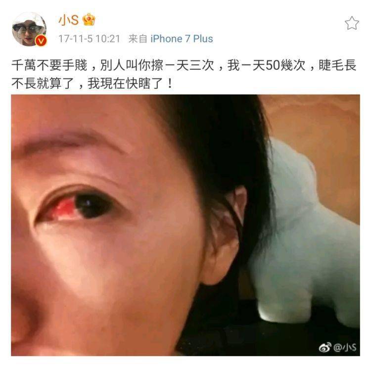 前列精灵般的睫毛，是眼睛自带的滤镜