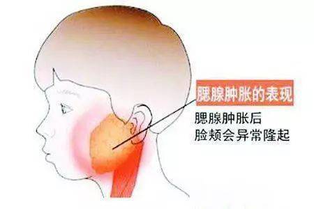 什么季节容易得带状疱疹 56346dcae6fd439bb2ff33914783e635.jpeg