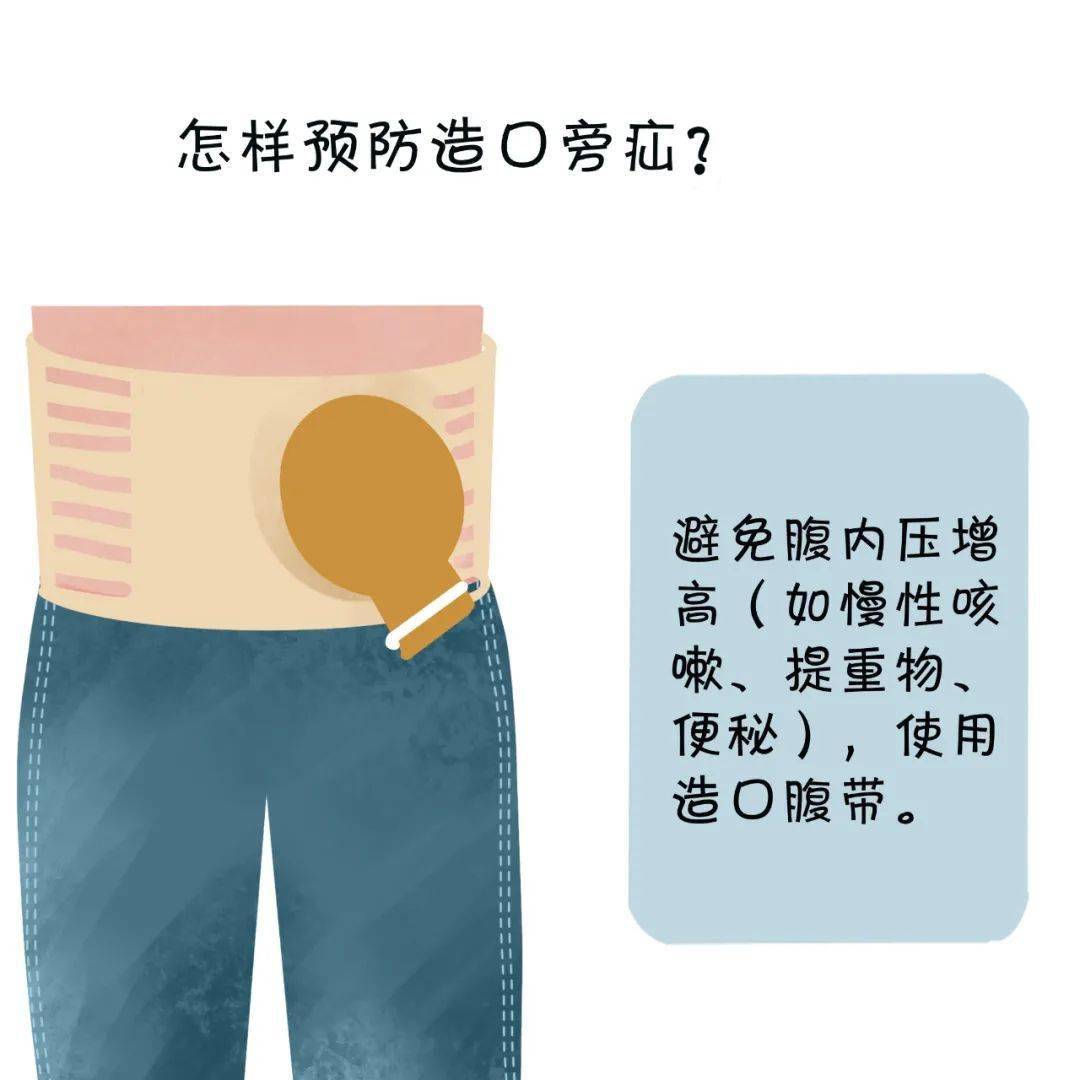 如何呵护身边的特殊人群——"肠造口人"?