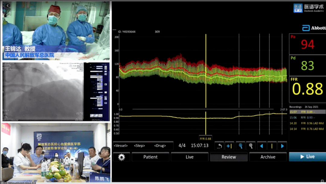 排序);期间,金琴花教授,杨俊杰教授将为大家介绍ffr的精准测量技巧