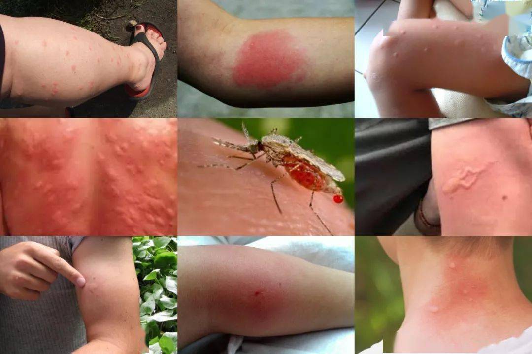 让蚊虫远离的目的夏季虽然过了但"秋蚊"咬人更狠家里放盒它别说蟑螂了