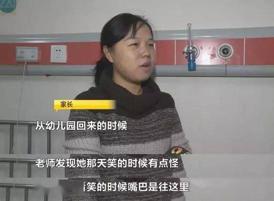 3岁孩子半张脸突然歪了 这病近期高发 赶紧重视起来 贝尔