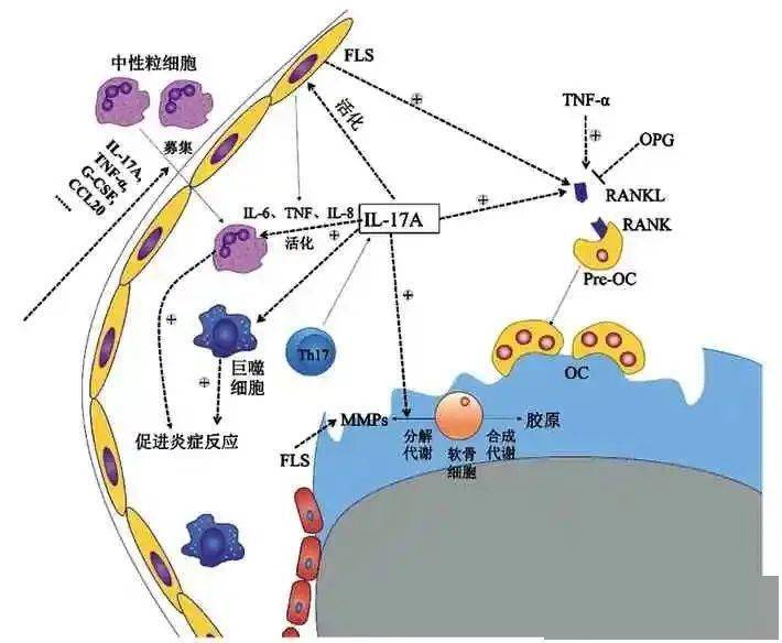 白介素17a抑制劑在類風溼關節炎中的作用