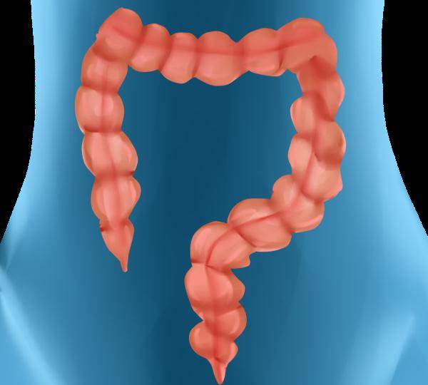 表弟|杭州一59岁男子与表弟双双查出肠癌！医生建议：早筛查早治疗很关键