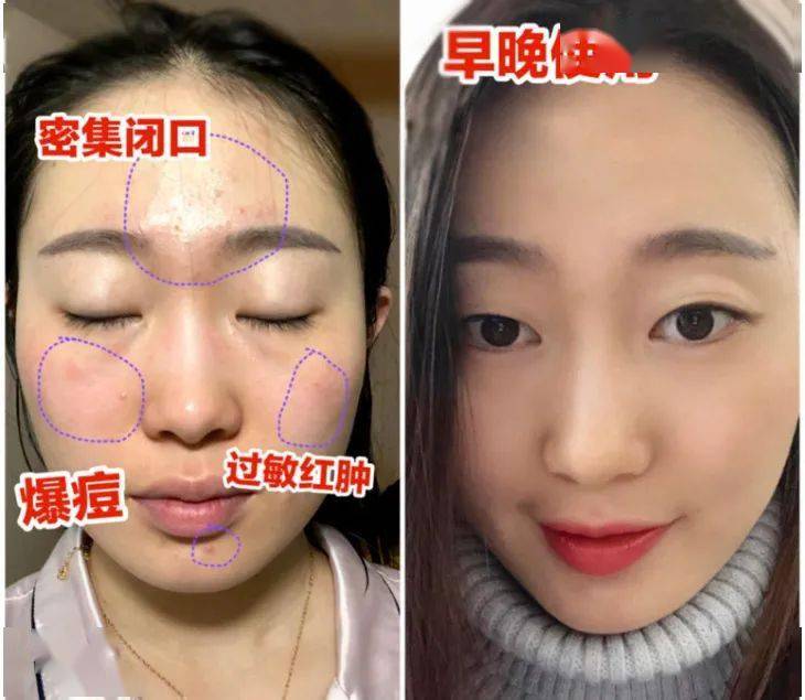 芮翰全网跟风的“雅诗兰黛高级脸”究竟长什么样？