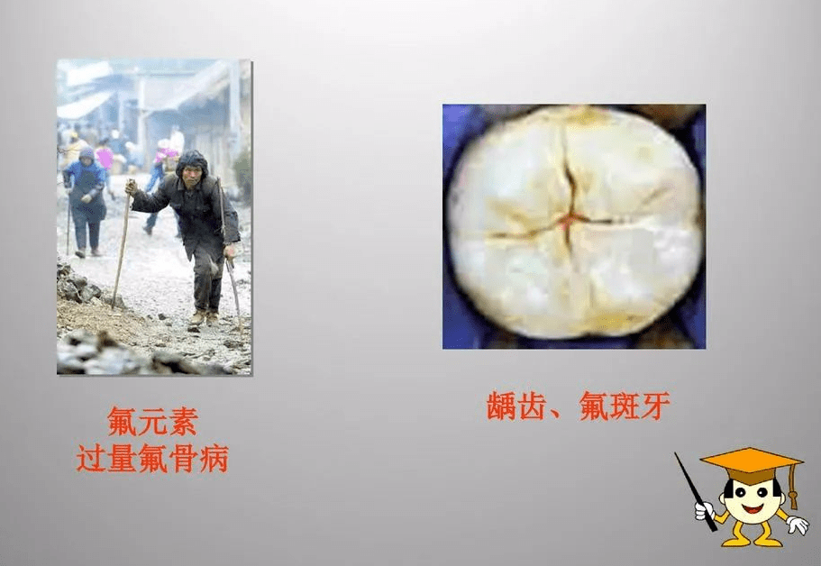 饮水型氟中毒是由于长期摄入含氟量超标的地下水引起的慢性中毒,在