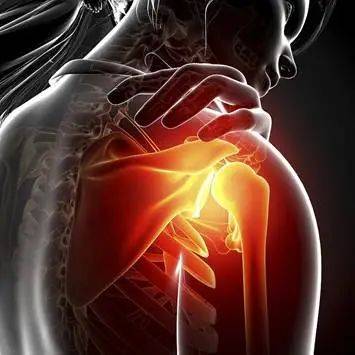 颈椎|小心！肩膀疼，不一定是肩周炎！背后可能隐藏数十种疾病