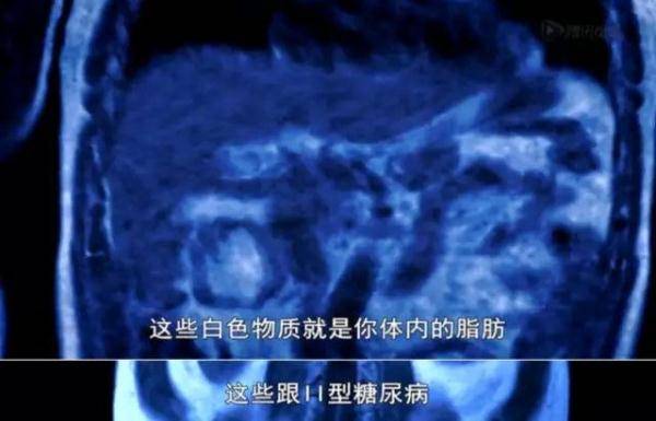 的测试|你每天的运动真的有效吗？英国一部纪录片的测试结果颠覆常识！