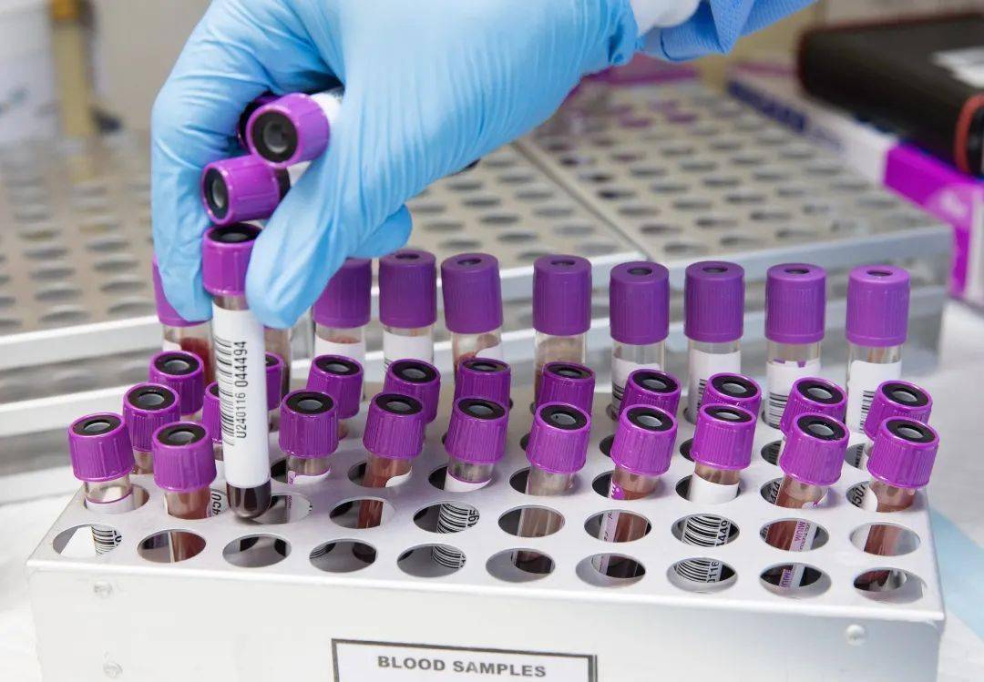 上世纪发现的脑炎病毒,这个夏天感染了数百位美国民众