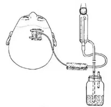 在头颅钻孔或锥孔,将硅胶引流管置于脑室,将脑脊液或血液经引流管流出