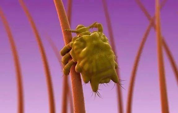 女子|杭州一女子双眼瘙痒难忍，医生都惊呆了