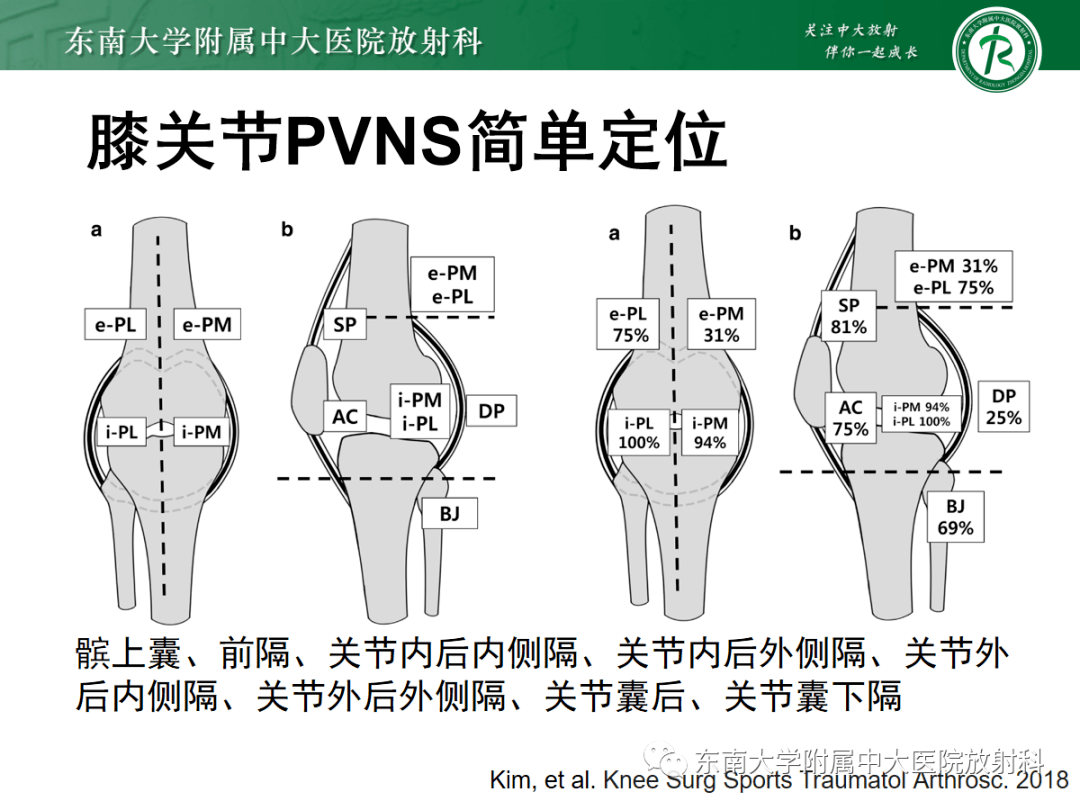 mr检查dr检查实验室检查:无专科检查:右膝关节肿胀,浮髌试验阳性,膝