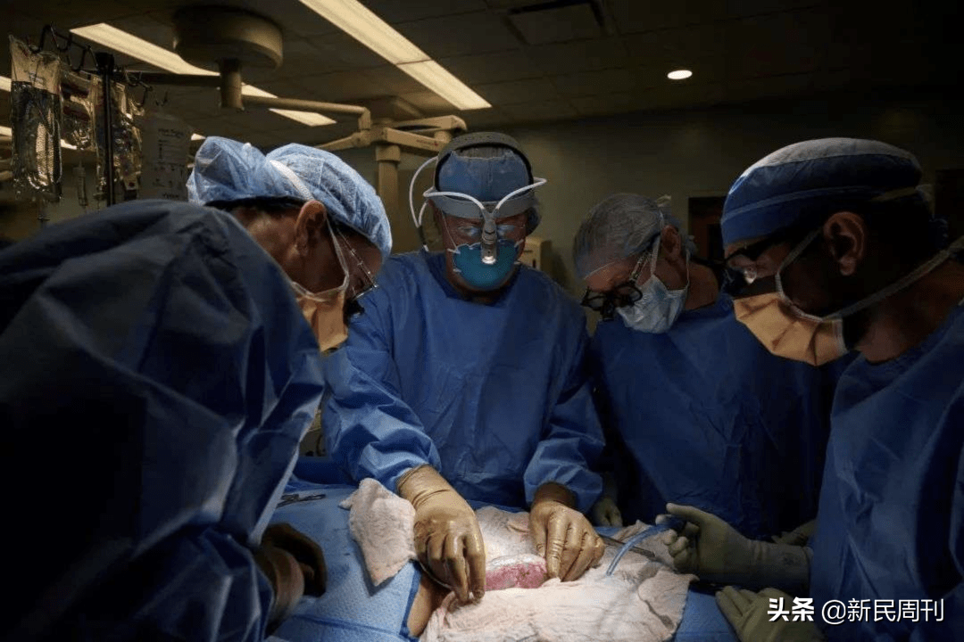 世界首例猪肾移植人体成功 作秀大于临床应用 器官