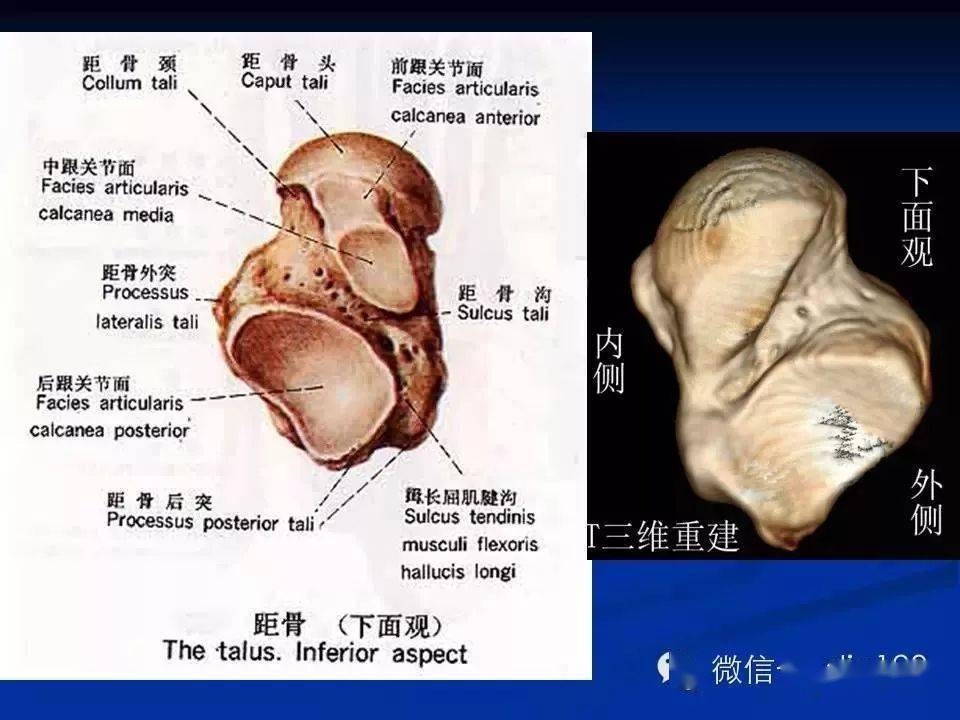 踝關節正位片膝關節半月板損傷mr掃描與診斷兒童肘關節骨折x線診斷12