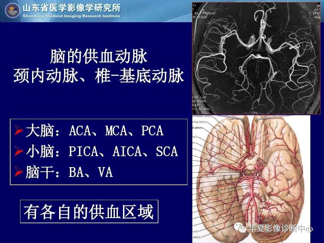 诊断|缺血性脑血管病的影像诊断