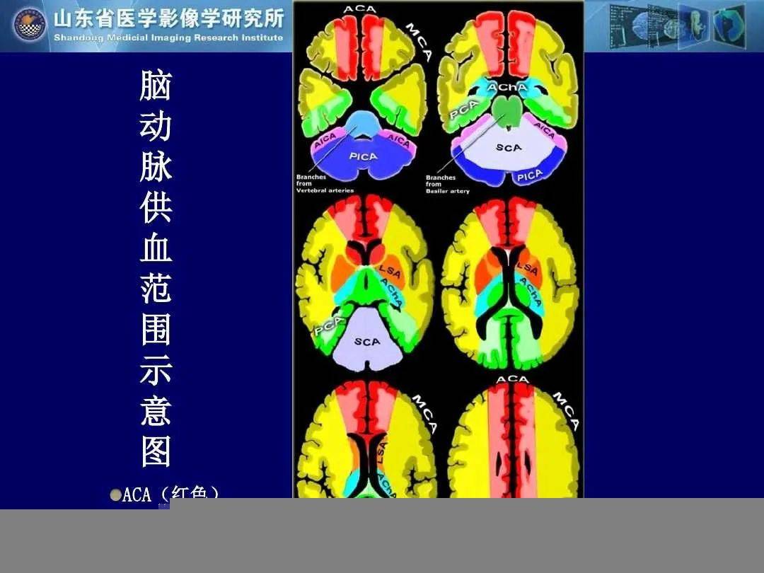 诊断|缺血性脑血管病的影像诊断