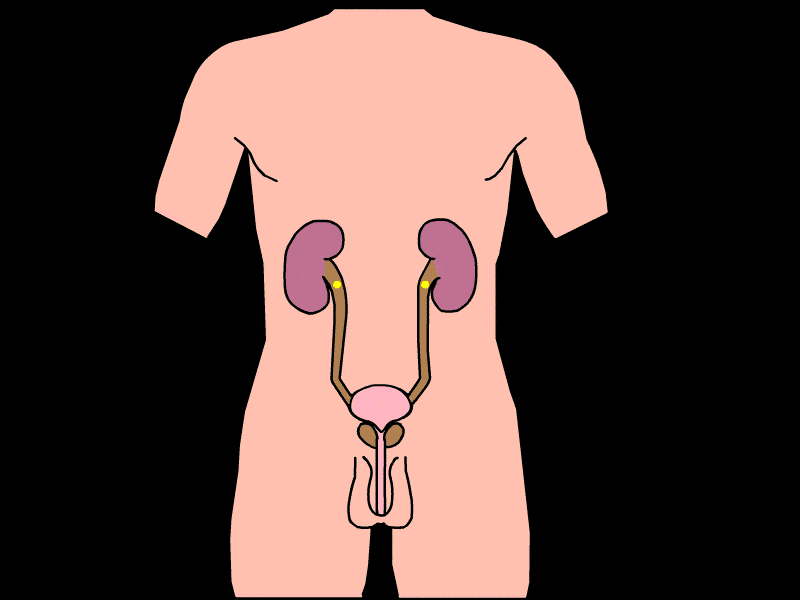 男性肾的位置图片