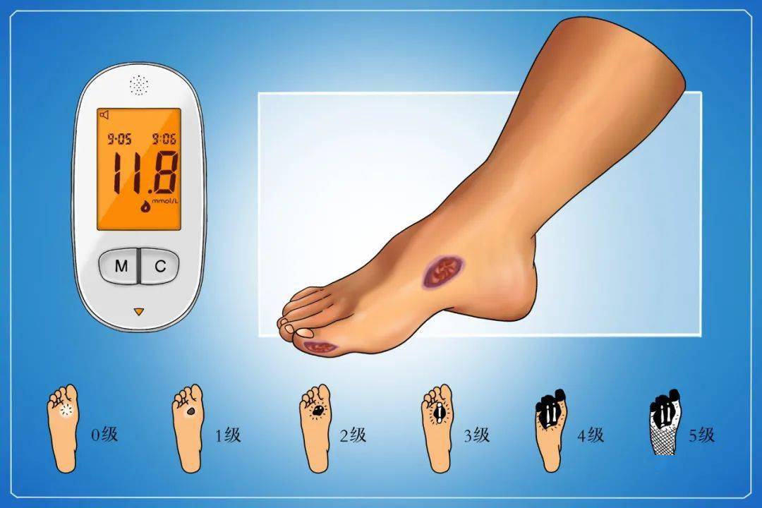 体重|联合国糖尿病日丨人人享有糖尿病健康管理