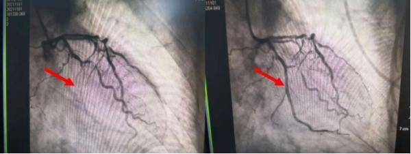 心脑血管|苏州一天近百人中招！医生紧急提醒：这几类人千万注意！