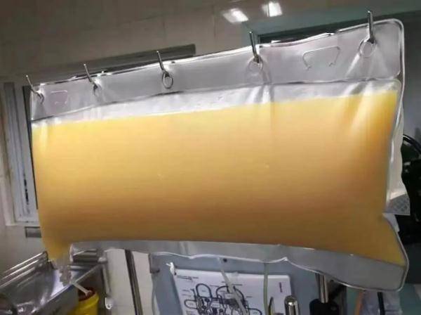 李震|男子体检血液如牛奶，从中抽出2升油浆……就因为爱吃这些→