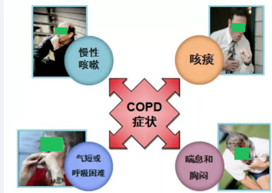 全稱為慢性阻塞性肺炎(chronic obstructive pulmonary disease,copd)