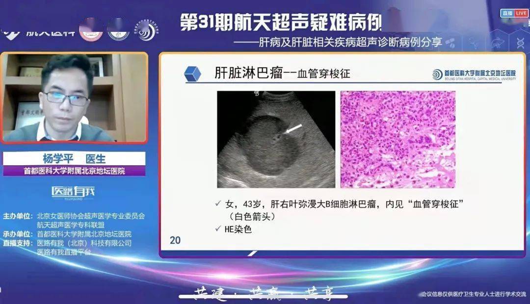 病例|超声疑难病例分享！这场会议在冬日里暖心上线