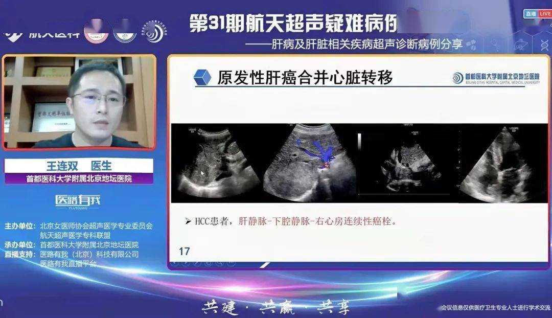 病例|超声疑难病例分享！这场会议在冬日里暖心上线