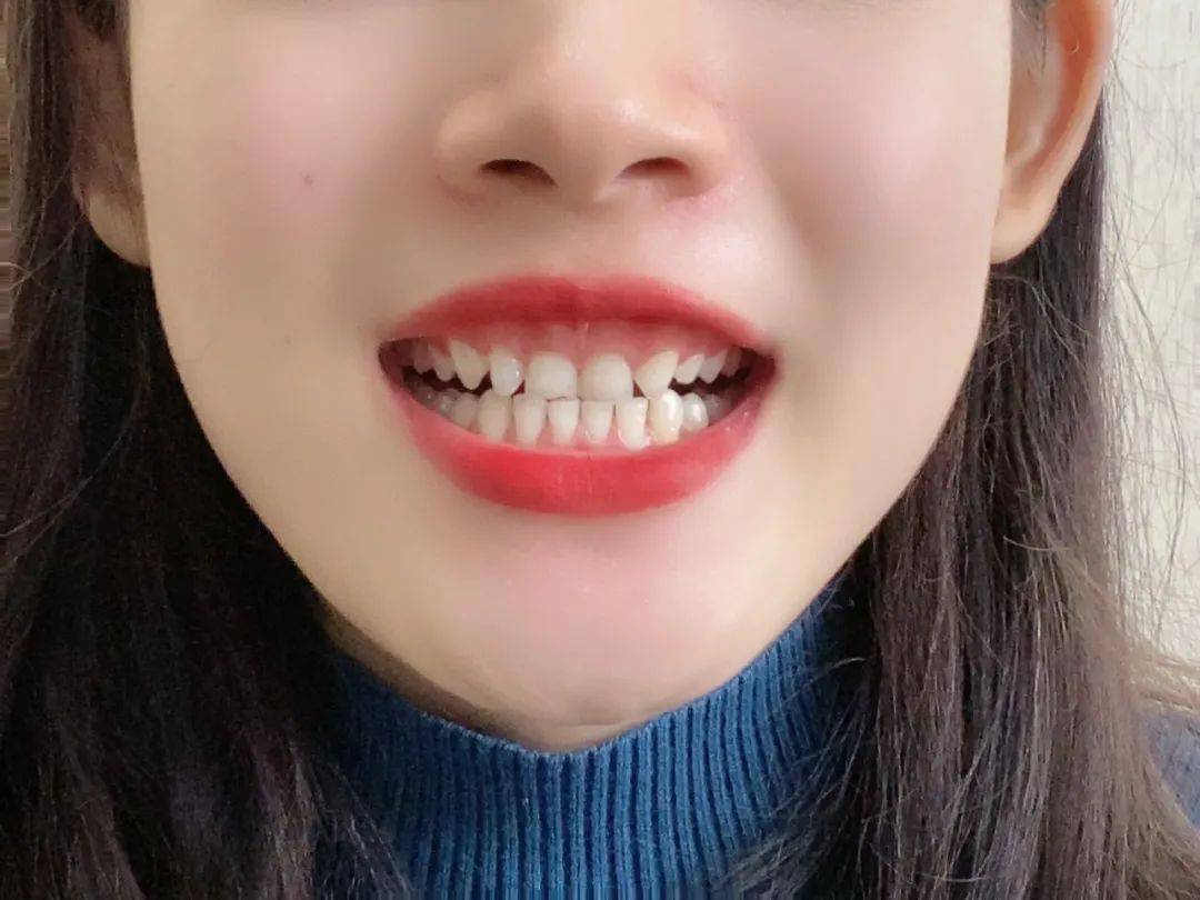 效果|又到火锅季，担心上火？降火神器了解一下