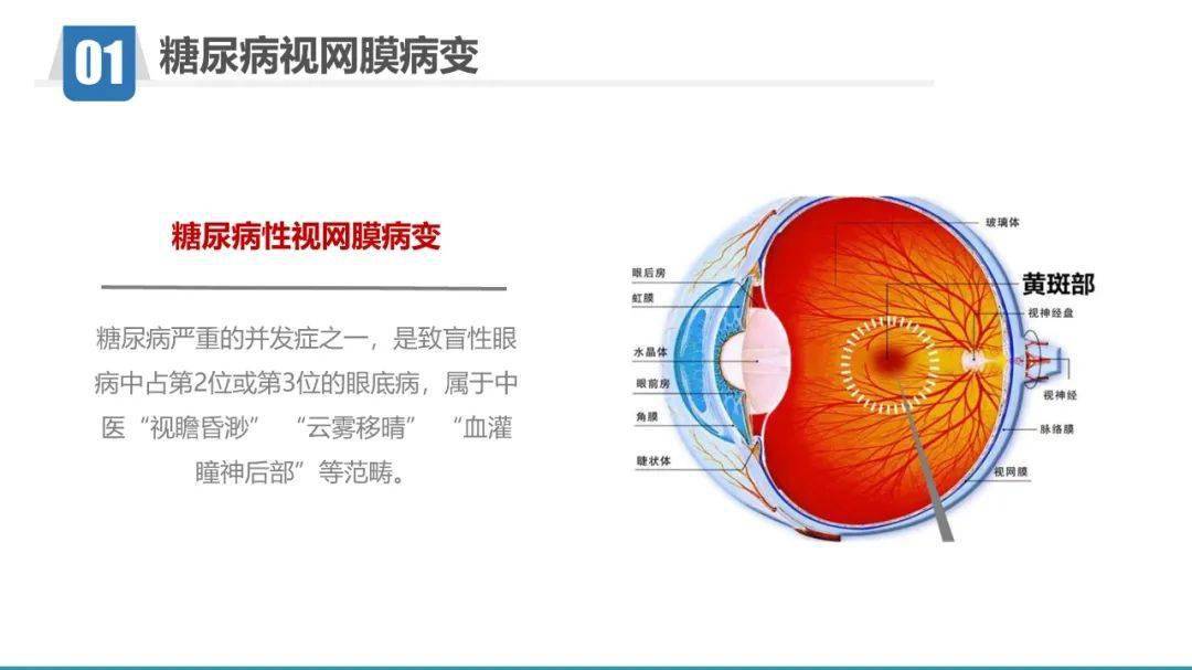 ppt糖尿病视网膜病变护理查房