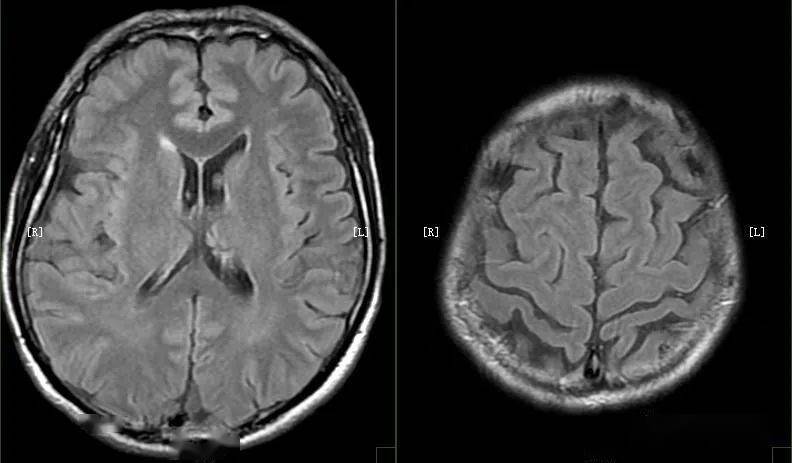 什么样的mri图像才是好图像
