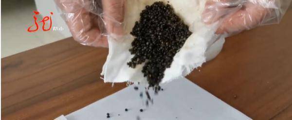 疾病|惊！黑龙江一女子体内取出400多颗胆结石！