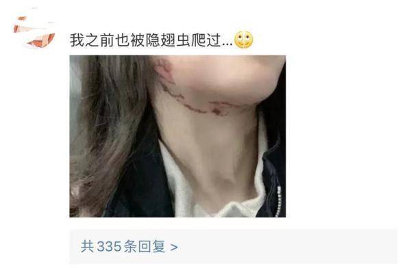 这种虫，是会飞的“硫酸”