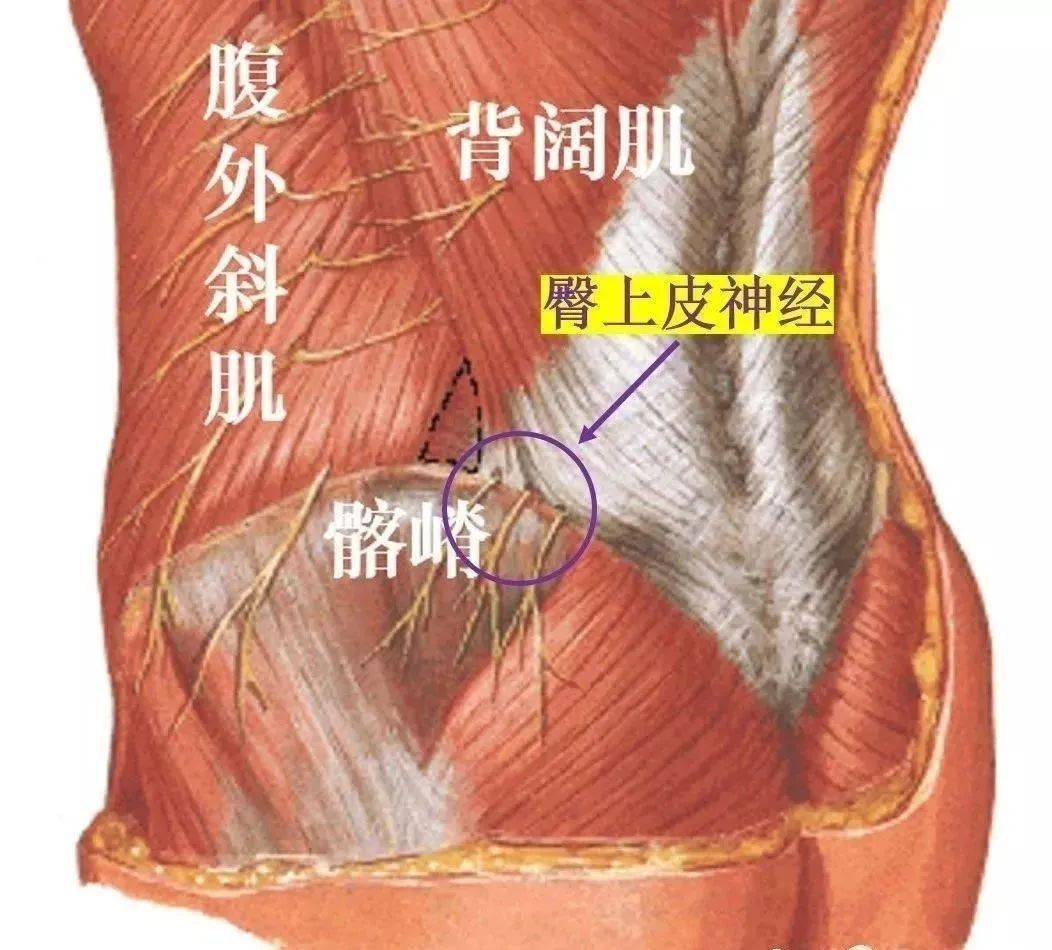 什么是腰肌筋膜炎