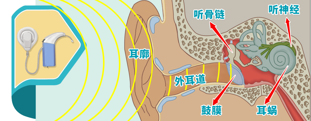 收 集外界声音 后,通过外耳道 传入 使鼓膜,听骨链产生振动,再 通过