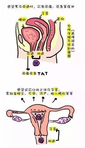 这里提醒一下女性朋友:患有阴道炎或者处在治疗期间,都是禁止性生活的