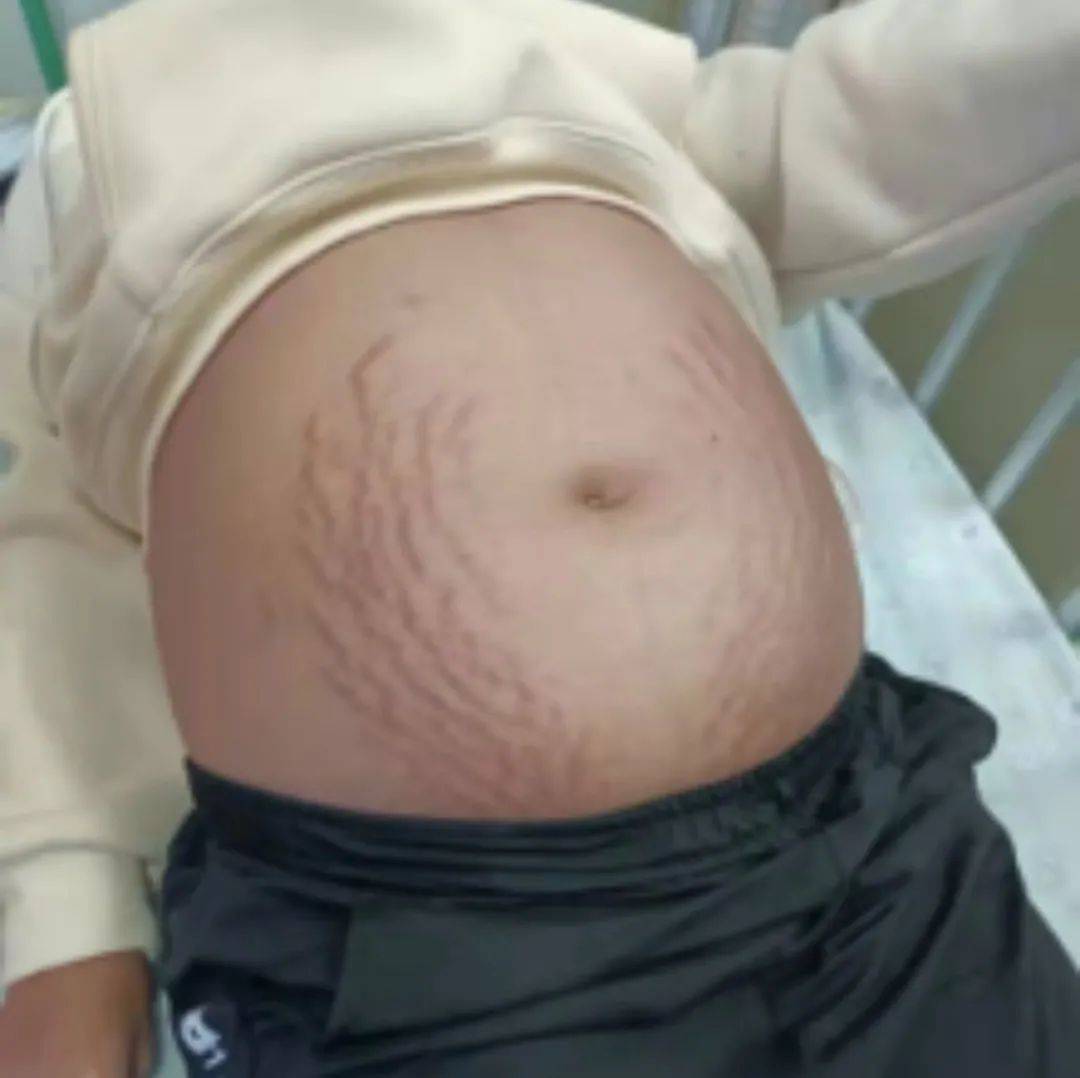 女人怀孕大肚子要生了_女人怀孕大肚子的视频大全 - 随意优惠券