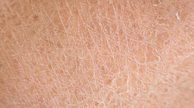 广州癫痫遗传鸡皮肤推荐的简单介绍 广州癫痫遗传鸡皮肤推荐的简单介绍