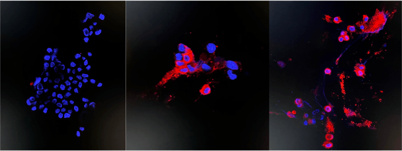 【992 | 最新】亚洲首个！香港大学成功分离奥密克戎毒株！