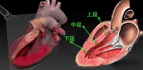 超声切面分法:分上段,中段,下段,就是在左室长轴切面切断,切线刚好