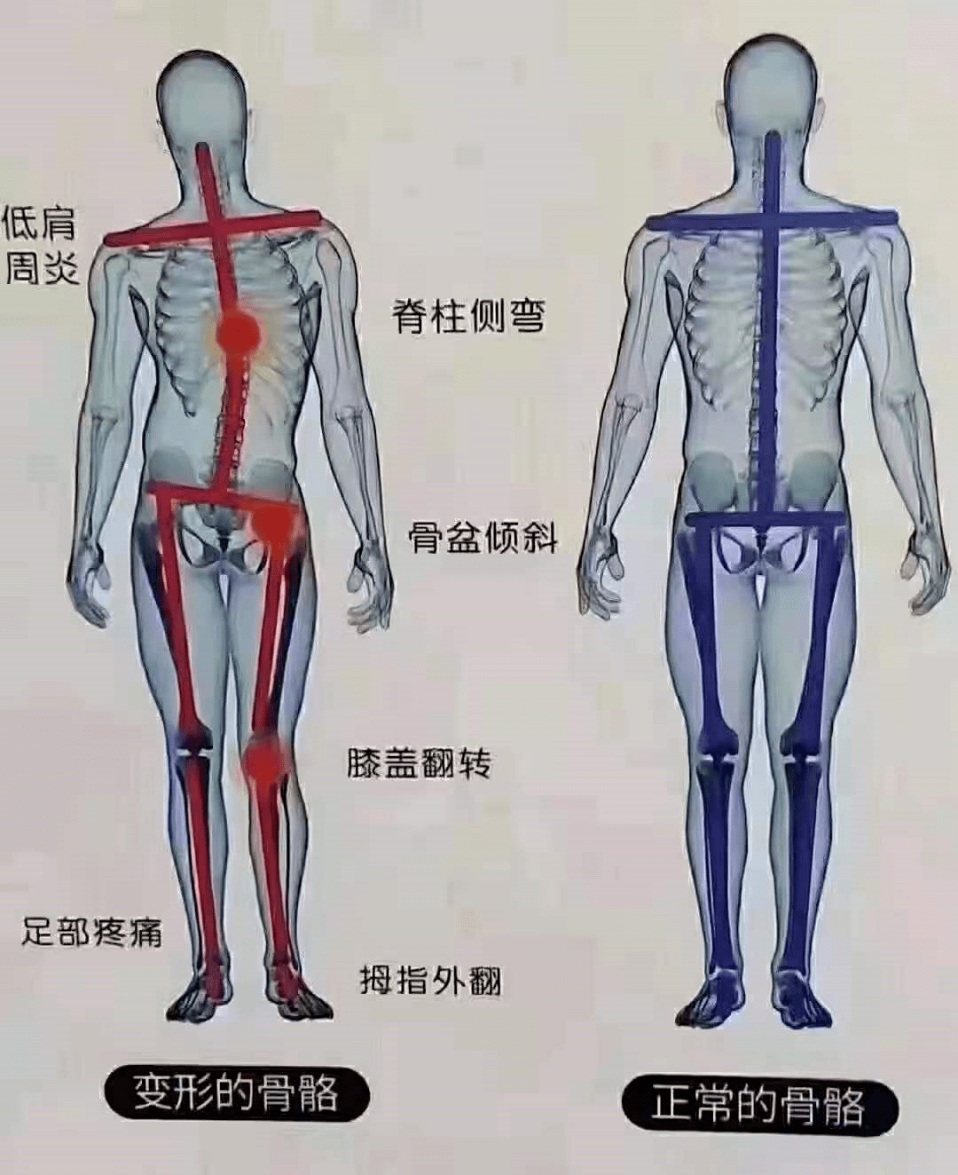 女人衰老的祸根原来是这个