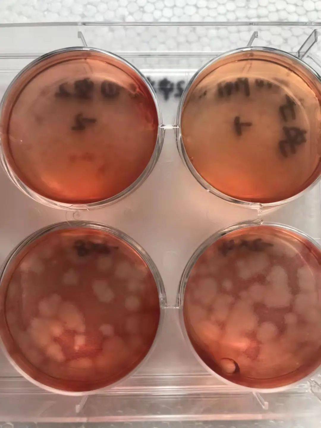 (柯萨奇病毒(ca10)形成的空斑(纯化目的病毒—用空斑实验的方法,逐